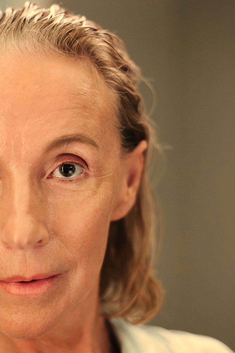 Hair Loss During Menopause